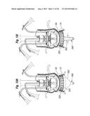 RAPID DEPLOYMENT METHODS FOR PROSTHETIC HEART VALVES diagram and image