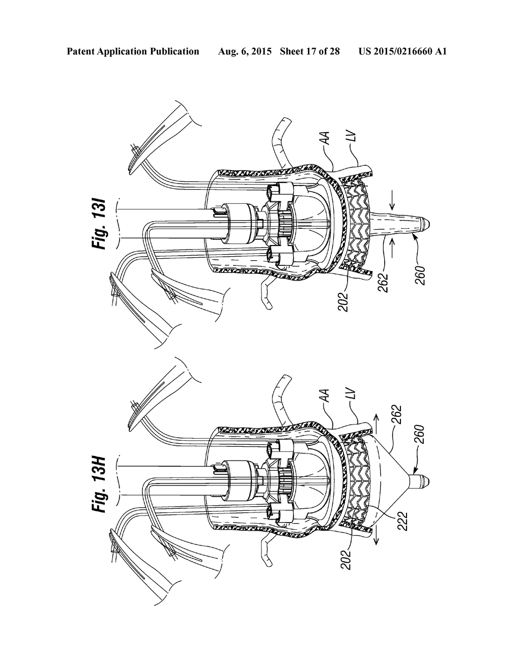 RAPID DEPLOYMENT METHODS FOR PROSTHETIC HEART VALVES - diagram, schematic, and image 18