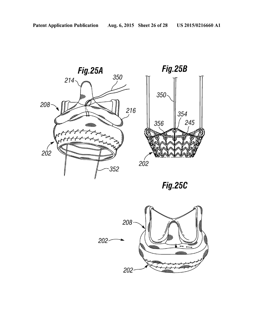 RAPID DEPLOYMENT METHODS FOR PROSTHETIC HEART VALVES - diagram, schematic, and image 27