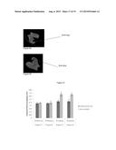 COMPOSITE BONE IMPLANTS diagram and image