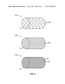 DUAL ROTATIONAL STENT APPARATUS AND METHOD FOR ENDOVASCULAR TREATMENT OF     ANEURYSMS diagram and image