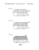 DUAL ROTATIONAL STENT APPARATUS AND METHOD FOR ENDOVASCULAR TREATMENT OF     ANEURYSMS diagram and image