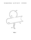 DUAL ROTATIONAL STENT APPARATUS AND METHOD FOR ENDOVASCULAR TREATMENT OF     ANEURYSMS diagram and image