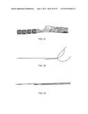 System and Methods for Treating a Bifurcation diagram and image