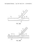 System and Methods for Treating a Bifurcation diagram and image