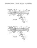 System and Methods for Treating a Bifurcation diagram and image