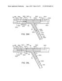 System and Methods for Treating a Bifurcation diagram and image