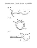 APPARATUS FOR TREATING OBESITY BY EXTRACTING FOOD diagram and image