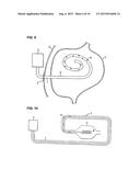 APPARATUS FOR TREATING OBESITY BY EXTRACTING FOOD diagram and image