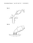 APPARATUS FOR TREATING OBESITY BY EXTRACTING FOOD diagram and image