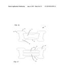 Nasal Dilator diagram and image