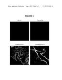 LIPID ASSEMBLIES COMPRISING ANIONIC LYSOLIPIDS AND USE THEREOF diagram and image