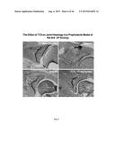 METHOD FOR TREATING INFLAMMATORY CONDITIONS diagram and image