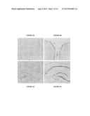 USE OF XENON AS NEUROPROTECTANT IN A NEONATAL SUBJECT diagram and image