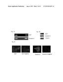 GALECTIN-3 INHIBITOR (GAL-3M) IS ASSOCIATED WITH ADDITIVE ANTI-MYELOMA AND     ANTI-SOLID TUMOR EFFECTS, DECREASED OSTEOCLASTOGENESIS AND ORGAN     PROTECTION WHEN USED IN COMBINATION WITH PROTEASOME INHIBITORS diagram and image