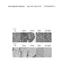 GALECTIN-3 INHIBITOR (GAL-3M) IS ASSOCIATED WITH ADDITIVE ANTI-MYELOMA AND     ANTI-SOLID TUMOR EFFECTS, DECREASED OSTEOCLASTOGENESIS AND ORGAN     PROTECTION WHEN USED IN COMBINATION WITH PROTEASOME INHIBITORS diagram and image