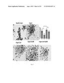 GALECTIN-3 INHIBITOR (GAL-3M) IS ASSOCIATED WITH ADDITIVE ANTI-MYELOMA AND     ANTI-SOLID TUMOR EFFECTS, DECREASED OSTEOCLASTOGENESIS AND ORGAN     PROTECTION WHEN USED IN COMBINATION WITH PROTEASOME INHIBITORS diagram and image