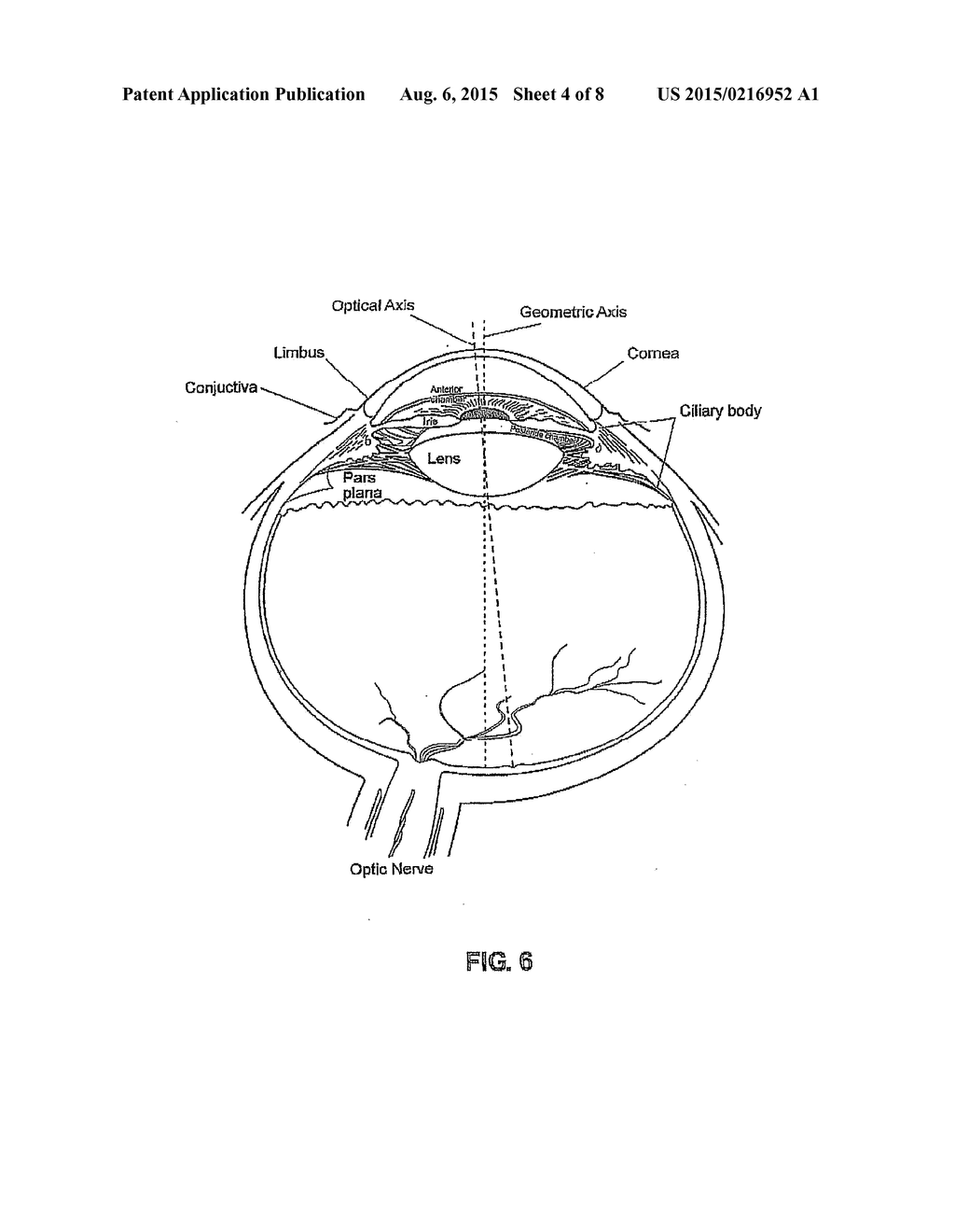 TREATMENT OF OPHTHALMIC CONDITIONS - diagram, schematic, and image 05