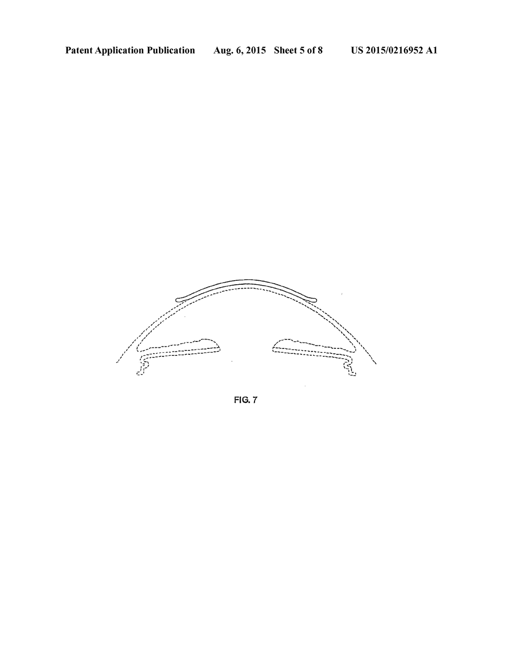 TREATMENT OF OPHTHALMIC CONDITIONS - diagram, schematic, and image 06