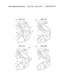 Superelliptical Breast Funnel diagram and image