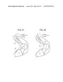 Superelliptical Breast Funnel diagram and image