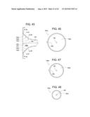 Superelliptical Breast Funnel diagram and image