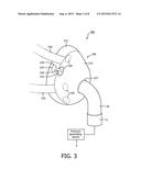 LEAK CORRECTION FOR A PATIENT INTERFACE DEVICE diagram and image