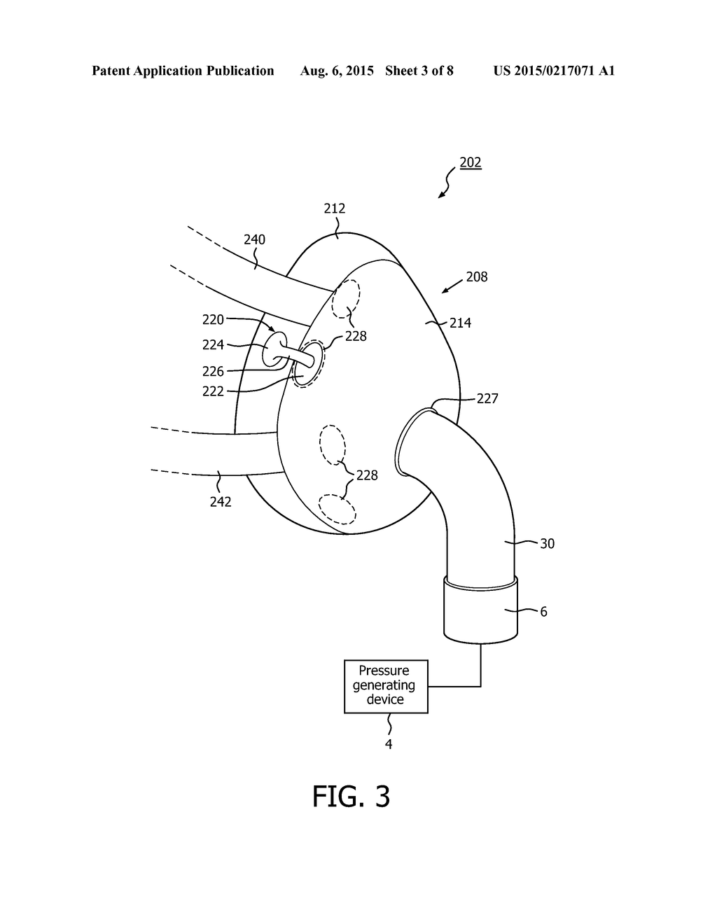 LEAK CORRECTION FOR A PATIENT INTERFACE DEVICE - diagram, schematic, and image 04