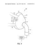 LEAK CORRECTION FOR A PATIENT INTERFACE DEVICE diagram and image