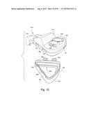 CUSHION TO FRAME ASSEMBLY MECHANISM diagram and image