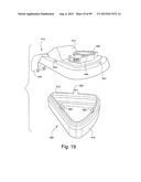 CUSHION TO FRAME ASSEMBLY MECHANISM diagram and image