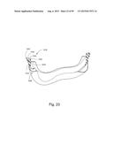 CUSHION TO FRAME ASSEMBLY MECHANISM diagram and image