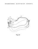 CUSHION TO FRAME ASSEMBLY MECHANISM diagram and image