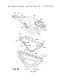 CUSHION TO FRAME ASSEMBLY MECHANISM diagram and image