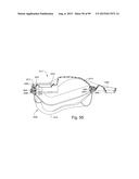 CUSHION TO FRAME ASSEMBLY MECHANISM diagram and image