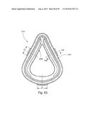 CUSHION TO FRAME ASSEMBLY MECHANISM diagram and image