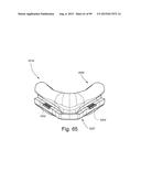 CUSHION TO FRAME ASSEMBLY MECHANISM diagram and image