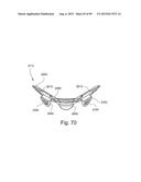 CUSHION TO FRAME ASSEMBLY MECHANISM diagram and image