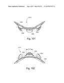 CUSHION TO FRAME ASSEMBLY MECHANISM diagram and image