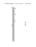 CRESCENT CHANNEL DYE FLOW ENABLED GUIDE CATHETERS diagram and image