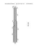 CRESCENT CHANNEL DYE FLOW ENABLED GUIDE CATHETERS diagram and image