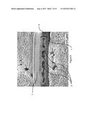 ANISOTROPIC NANOPOROUS COATINGS FOR MEDICAL IMPLANTS diagram and image