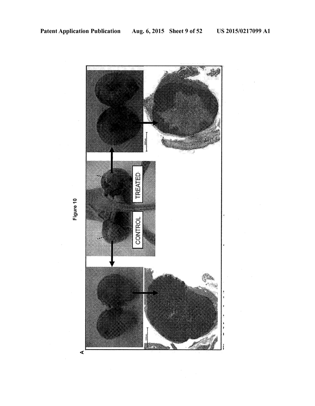 TUMOR VACCINATION - diagram, schematic, and image 10