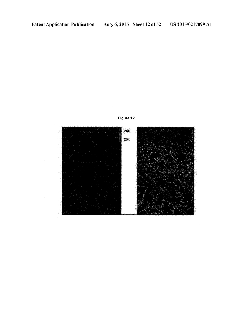 TUMOR VACCINATION - diagram, schematic, and image 13