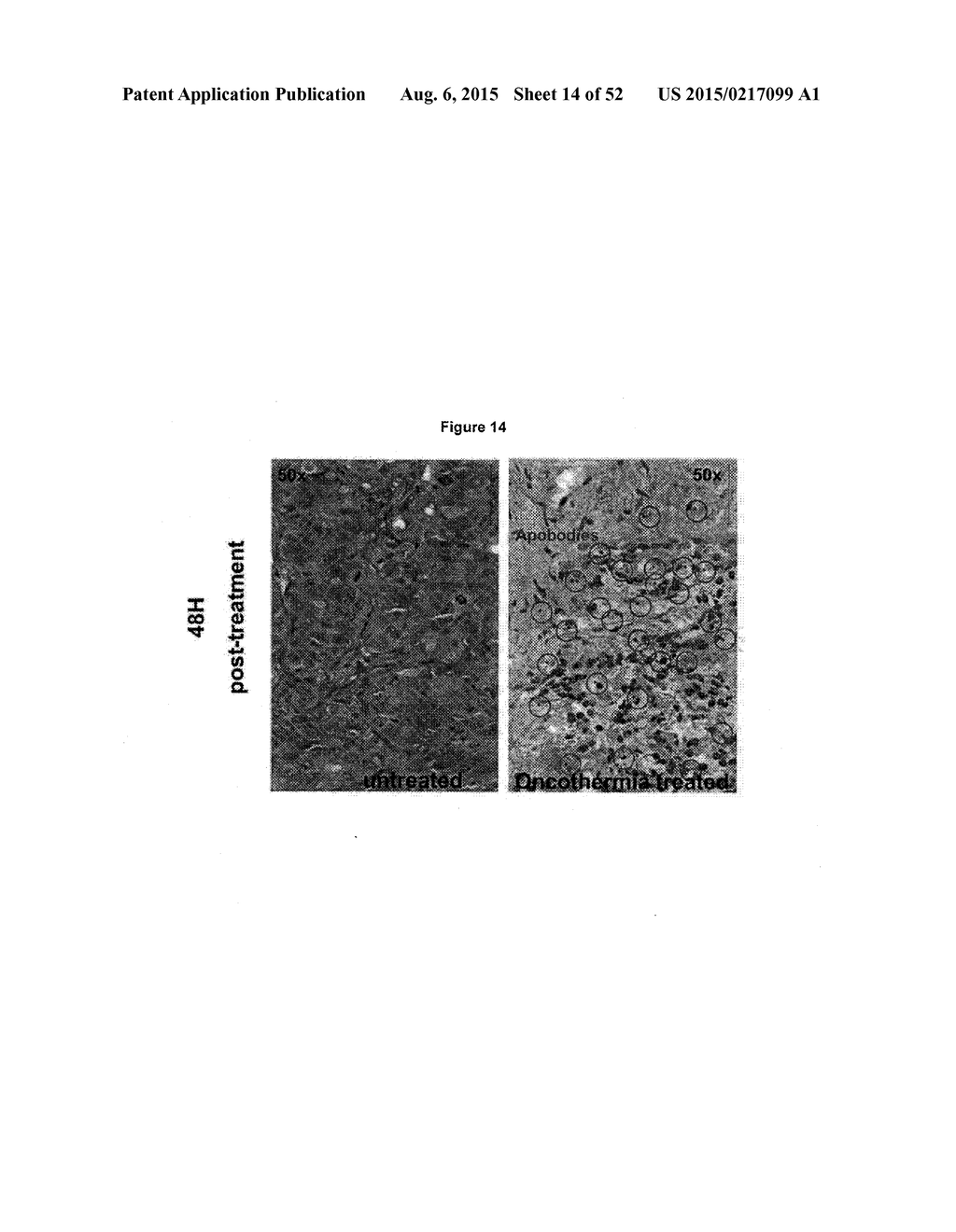 TUMOR VACCINATION - diagram, schematic, and image 15