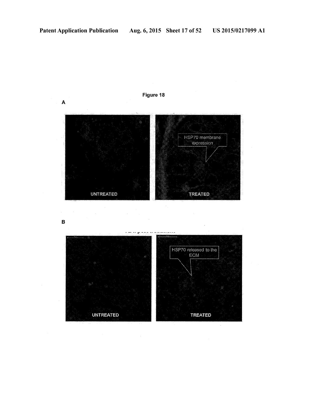 TUMOR VACCINATION - diagram, schematic, and image 18