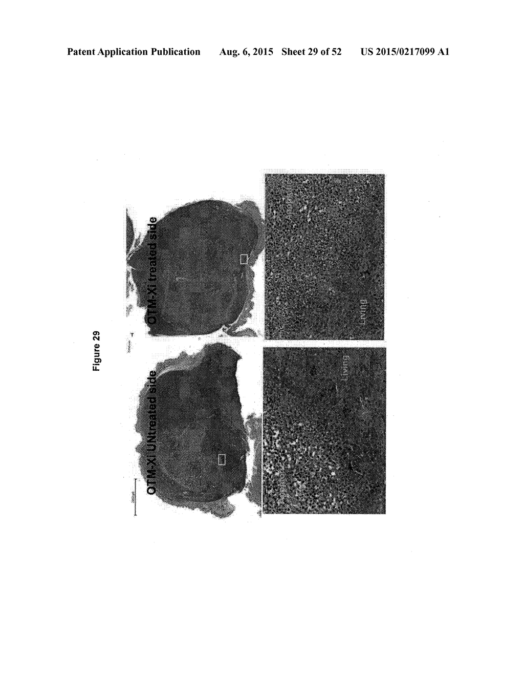 TUMOR VACCINATION - diagram, schematic, and image 30