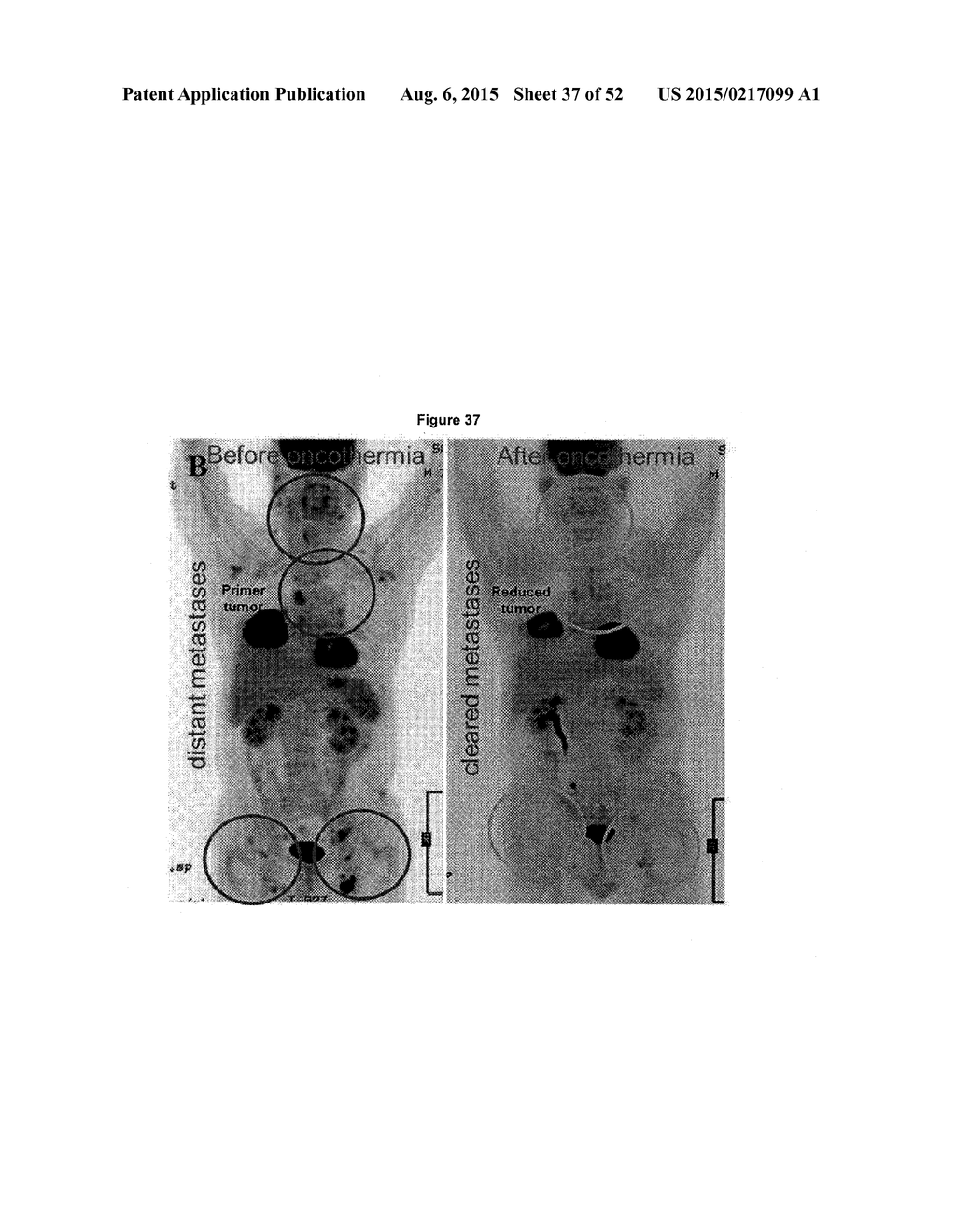 TUMOR VACCINATION - diagram, schematic, and image 38