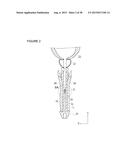 URETHRAL STRICTURE TREATMENT METHOD diagram and image