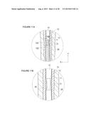 URETHRAL STRICTURE TREATMENT METHOD diagram and image